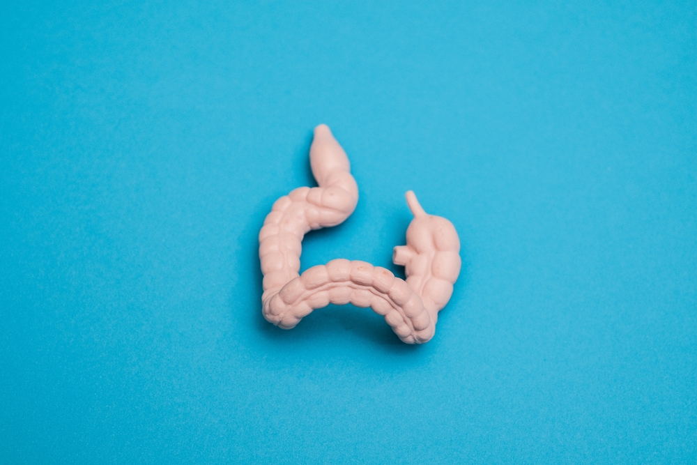 Diverticular disease and diverticulitis presentation