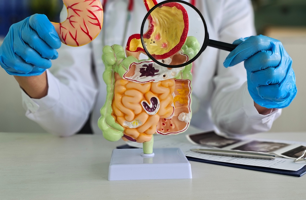 Inflammatory bowel disease presentation