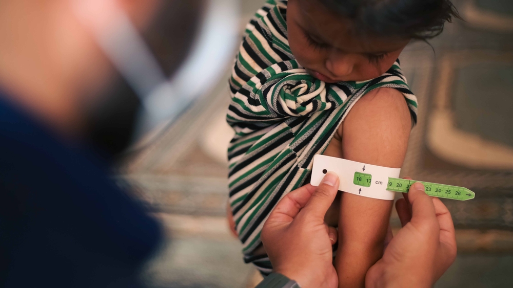Malnutrition presentation