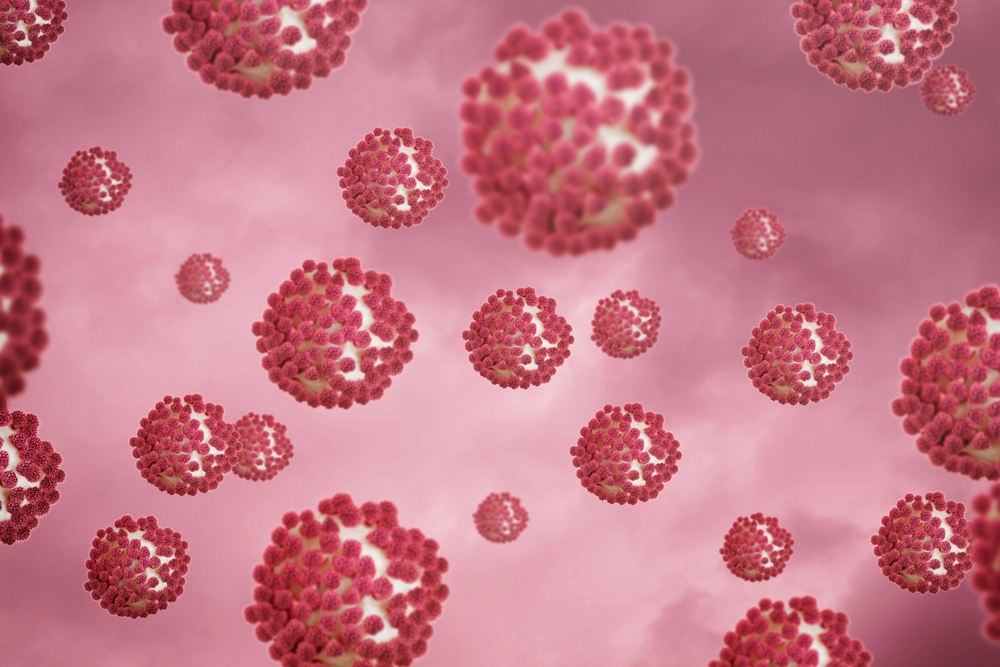 Food poisoning - sources, signs and symptoms presentation